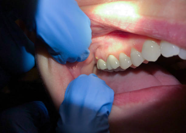 Best 24-Hour Dental Clinic Near Me  in Byng, OK
