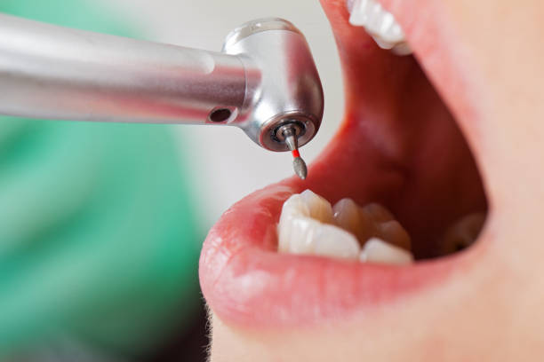 Best Emergency Dental Services Near Me  in Byng, OK
